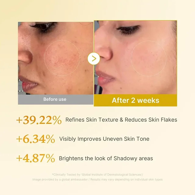 تونر روشنکننده گوجیک اسید و زردچوبه مدیکیوب مدل Kojic Acid Turmeric Resurfacing Toner حجم 250 میلیلیتر